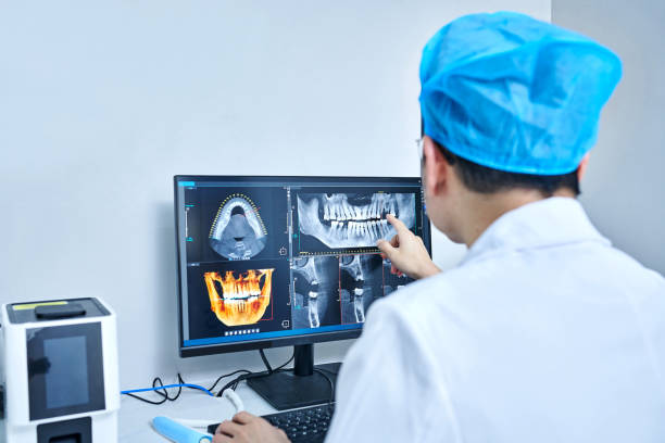 Best Knocked-Out Tooth (Avulsed Tooth) Treatment in Glencoe, IL